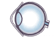 Presbyopia