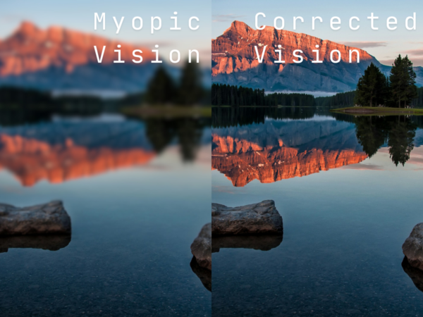 Myopia or nearsighted