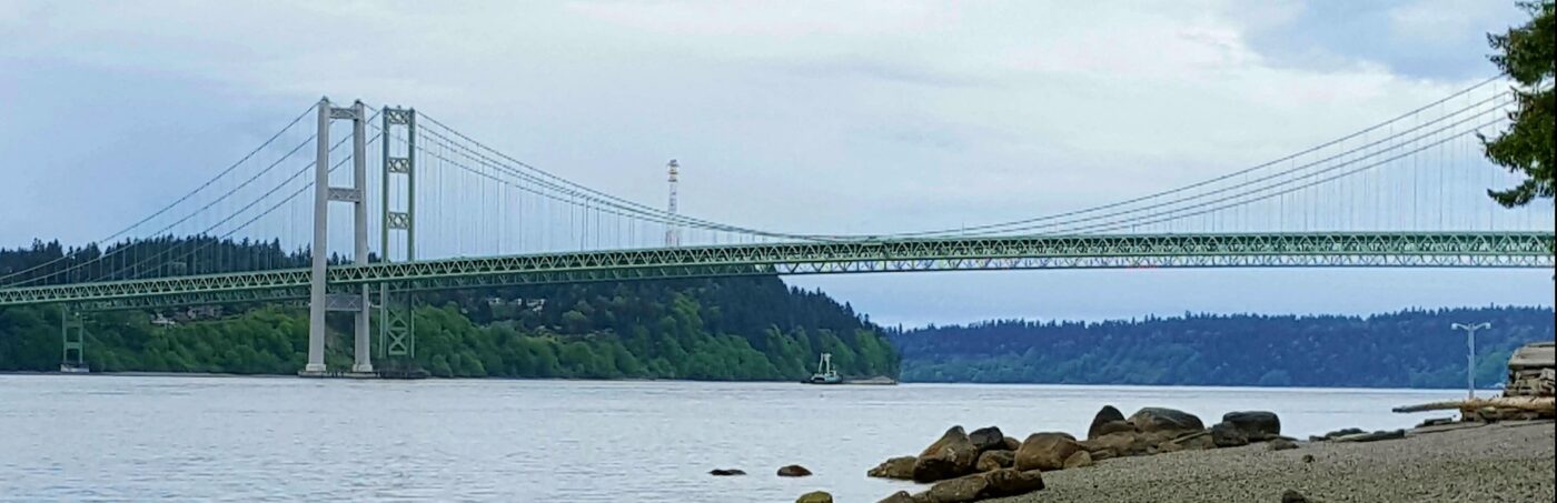LASIK in Tacoma, WA