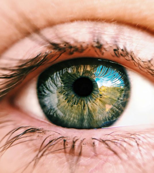 does lasik change eye color